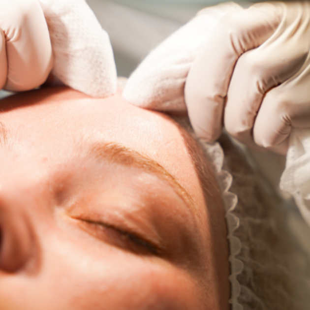 Combat Hormonal Acne: How Lifestyle & Care Impact Your Skin